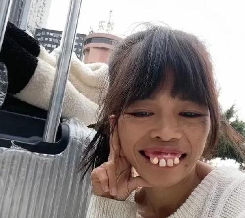 龅牙网红嘟嘟6,龅牙网红的逆袭之路